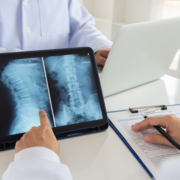 Doctor,Diagnose,Spine,Lumber,Vertebrae,X-ray,Image,On,Digital,Tablet