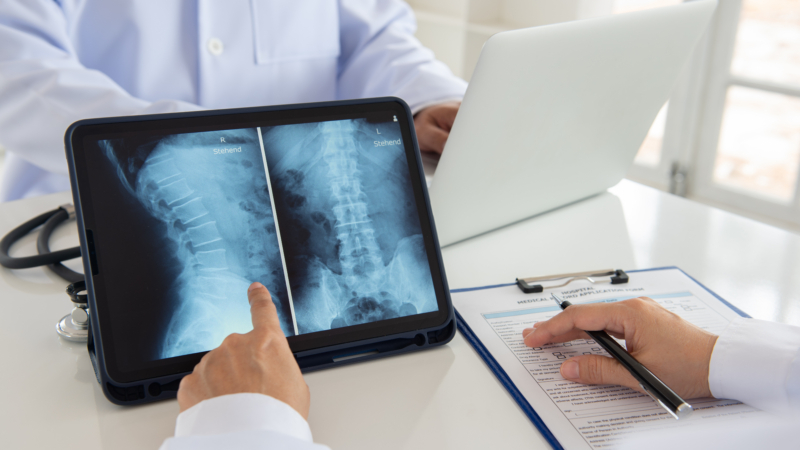 Doctor,Diagnose,Spine,Lumber,Vertebrae,X-ray,Image,On,Digital,Tablet